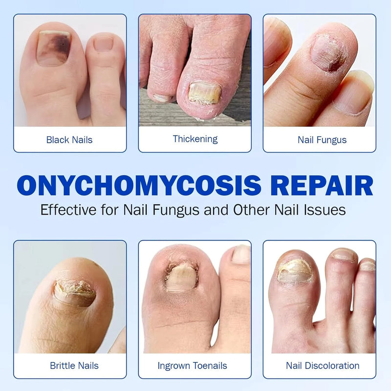 Night Repair Nail Patches