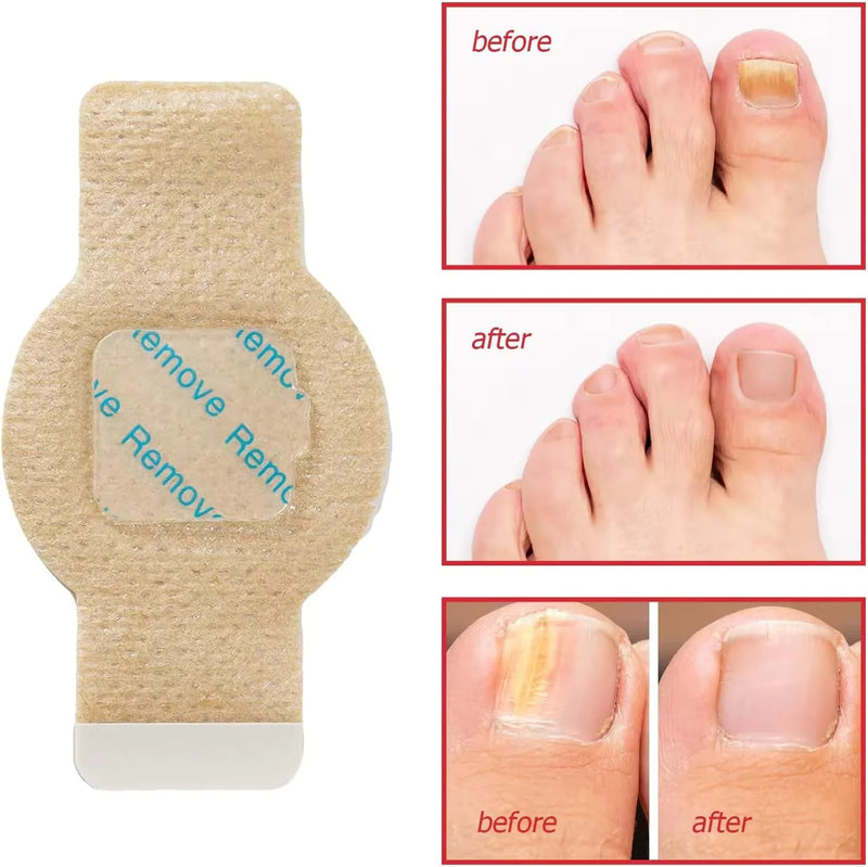 Night Repair Nail Patches
